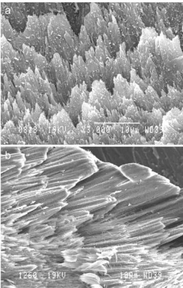 Fig. 8 SEM. Inside view of the bone of a broken mandible of O.