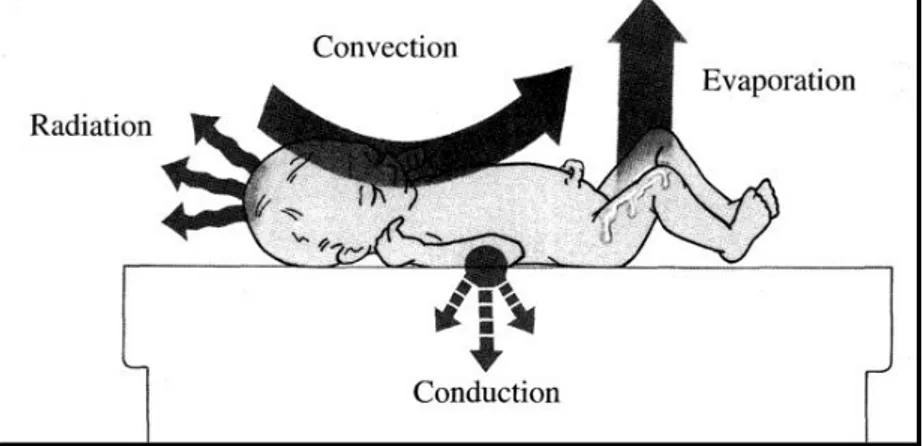 Figure 1 : Quatre mécanismes de perte thermique du nouveau-né, OMS, La protection  thermique du nouveau-né : guide pratique