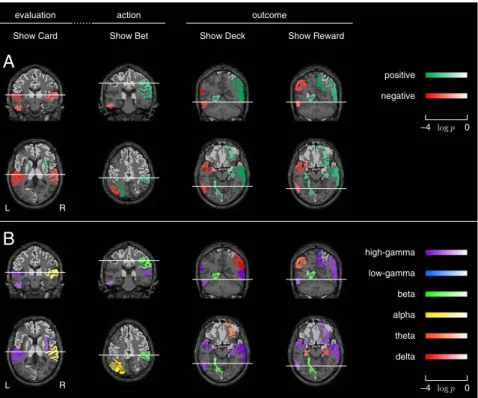 Fig. 6. SEEG maps of neural circuits encoding dynamic bias (multiparticipant plots). SEEG maps represent, in MRI slices, the brain regions where the oscillatory power of the SEEG neural activity significantly modulates with dynamic bias at different epochs