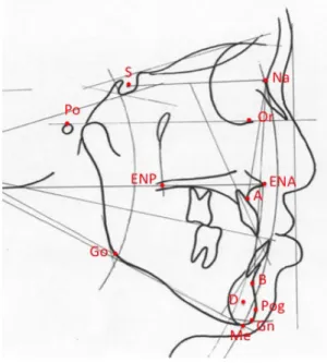 Figure  6:  Examens  complémentaires  d'un  jeune  patient  présentant  une  classe  III  squelettique A : Téléradiographie de profil