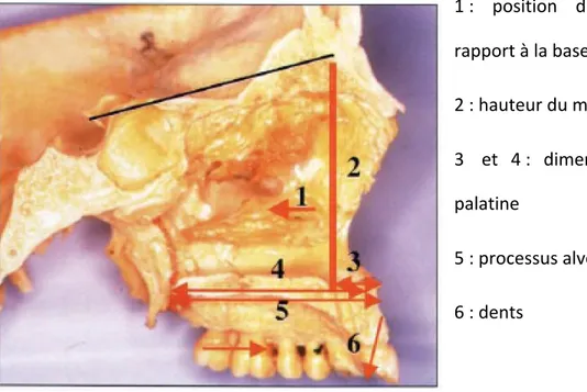 Figure 7: Paramètres pouvant engendrer une insuffisance maxillaire 