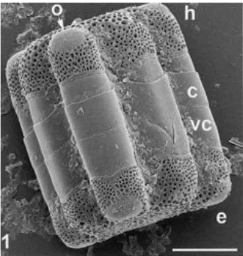 Figure 3 : Diatomée 'Hydrosera' (e) épithèque et (h) hypothèque. (Source : Diatom Wolrd 1 ) 