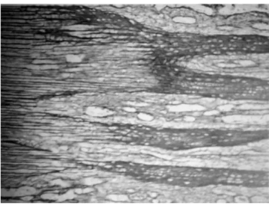 Figure  8 :  Micrographie  par  balayage  électronique  montrant  une  régénération  de  qualité