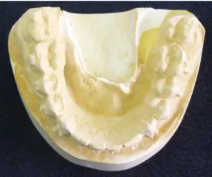 Figure 11 : Modèle  B mandibulaire : vue occlusale. Photo de l’auteur. 