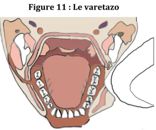 Figure   11   :   Le   varetazo   