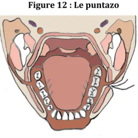 Figure   12   :   Le   puntazo   