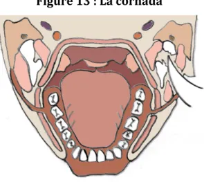 Figure   13   :   La   cornada   