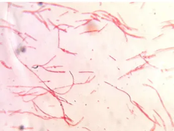 Figure 6 : Observation  au microscope optique de Fusobacterium nucleatum   (crédit photo A