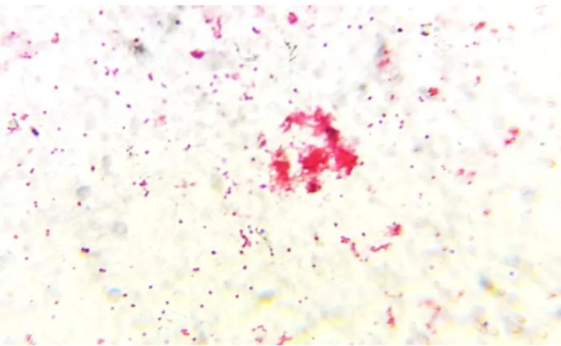 Figure 7: Observation au microscope optique de Porphyromonas gingivalis   (crédit photo par A