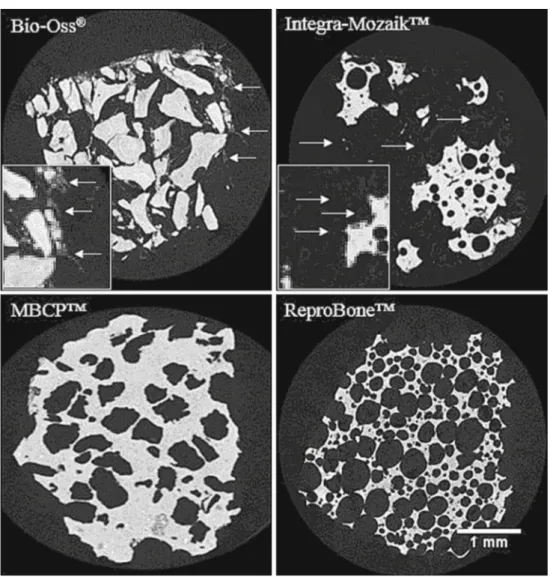 Fig. 3 Typical cross-sectional microCT images of the scaffolds. The CaP phase is clearly visible in light grey tones