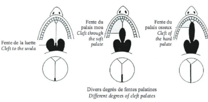 Figure 5:  Fentes intéressant le palais secondaire (7). 