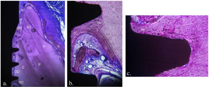 Fig.  17.  Implantation  au  contact  du  complexe  dentino-pulpaire  d’une  racine  résiduelle  chez le chien