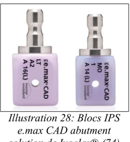 Illustration 29: Set TiBase de SIRONA®.(75)