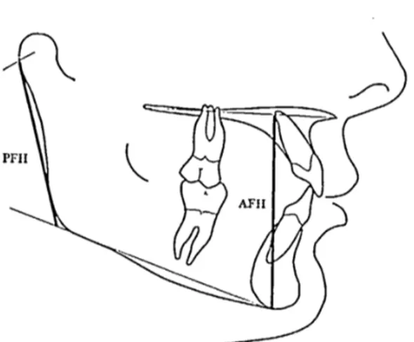 Figure 10 - Normes céphalométriques : index facial 