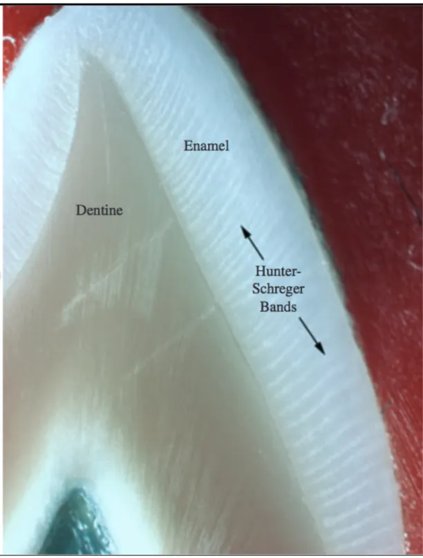 Figure 2 : image en lumière réfléchie mettant en évidences les bandes de Hunter-Schreger sur  la face vestibulaire d’une canine maxillaire 