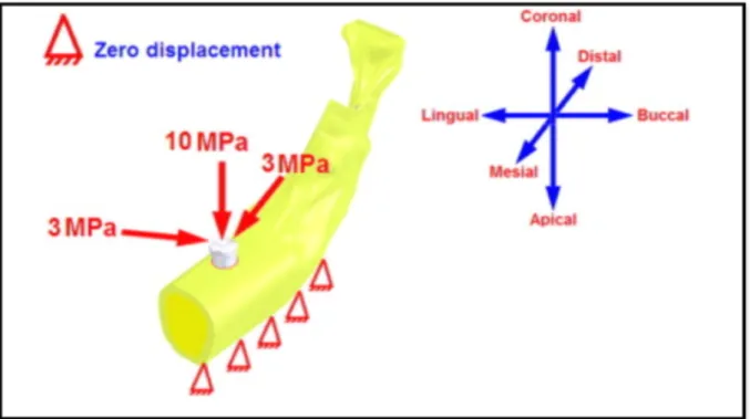 Figure 6 : schéma des forces subies par une molaire  