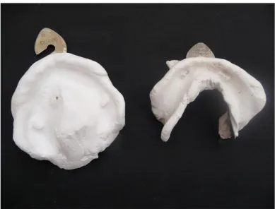 Figure 12 – Empreintes mucostatiques maxillaire et mandibulaire au plâtre