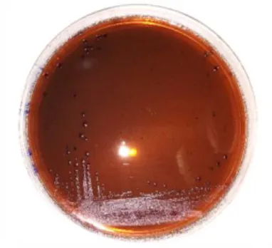 Figure 5 – Culture de Klebsiella sur gélose EMB en méthode d’isolement par quadrants  (Crédit photo : L.Bellaucq) 