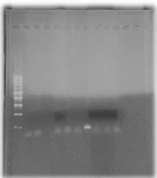 Figure 7 - Résultats de tests par PCR pour les Staphylocoques  (Crédit photo : L.Bellaucq) 