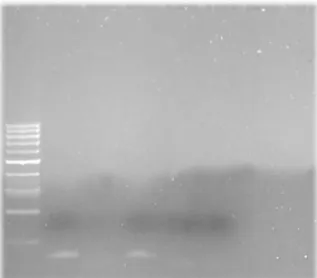 Figure 9 - Gel obtenu à l’issue de la PCR et de l’électrophorèse des échantillons  présumés Staphylococcus aureus et epidermidis 
