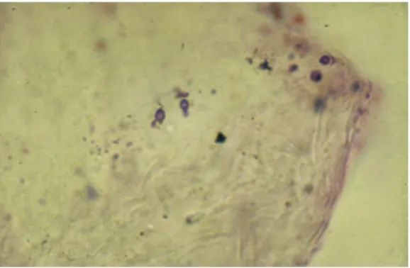 Figure 2 Malassezia yeasts at the surface of the stratum corneum.