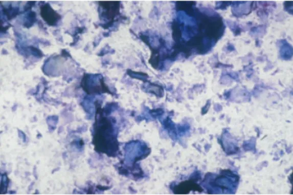 Figure 4 Dandruff collected by the squamometry proce- proce-dure.