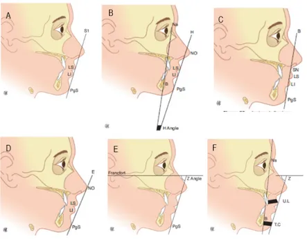 Figure 9. Les analyses céphalométriques de: Steiner (A), Holdaway (B), Burstone  (C), Ricketts (D) et Tweed-Merrifield (E,F) 