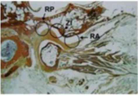 Figure 2: coupe histologique para-sagittale oblique de l’ATM droite dans l’axe du muscle ptérygoïdien latéral de l’étage  articulaire supérieur