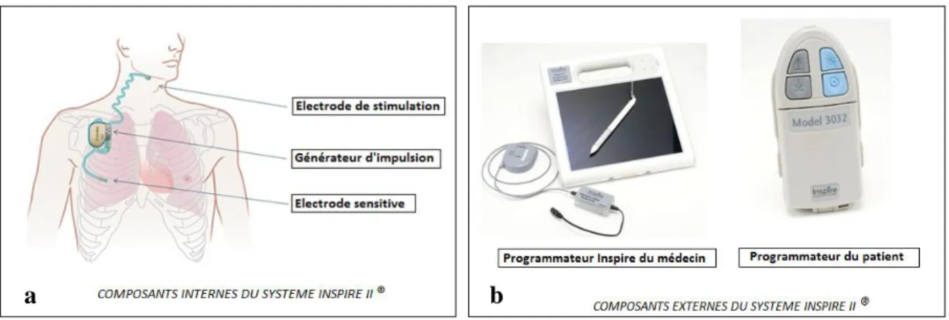 Fig. 2 : Composants du système INSPIRE® II. a) composants implantables. b) composants externes
