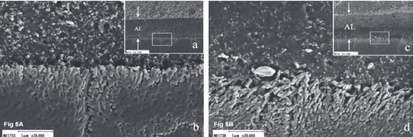 Figure 10 : Images représentatives au microscope électronique à balayage de l’interface adhésif-émail