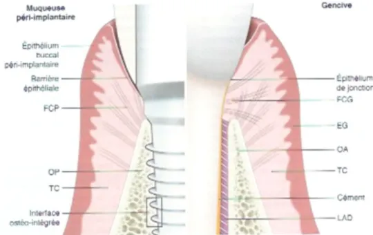 Fig. 2 : Principales différences entre les tissus parodontaux et péri-implantaires (Dr GAULTIER F 2015)  FCP : fibres conjonctives péri-implantaires, FCG : FC gingivales, EG : épithélium gingival, OA : os 