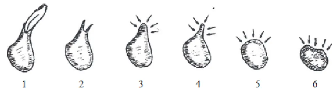 Figure 10 : Formes de crête mandibulaire antérieure selon Atwood (74) 
