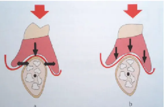 Figure 19 : Influence de l’inclinaison des versants cuspidiens   sur les composantes de forces horizontales (4) 