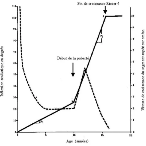 Figure 30 Corrélation entre la croissance et l'évolution de la scoliose 