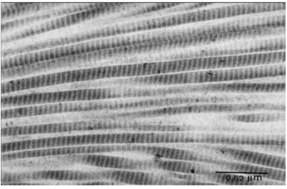Figure 2 : Association de fibrilles de collagène de type I et de type III avec l’aspect strié caractéristique                      en microscopie électronique (11) 