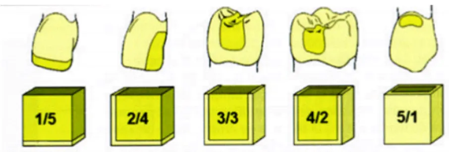 Figure 7 : le facteur de configuration cavitaire ou facteur « C » 6