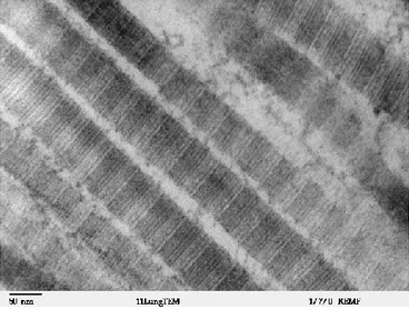 Figure 1-2. Fibres de collagène de type I vues par microscopie électronique à transmission