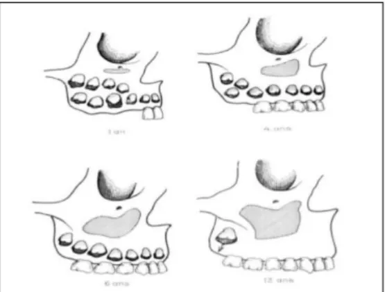 Figure 4 : Développement du sinus maxillaire 
