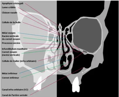 Figure 5 : Schéma d’une coupe TDM frontale des fosses nasales et des sinus maxillaires 