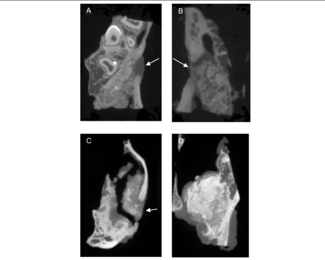 Figure 2 : Images tomographiques. Les flèches blanches marquent la fenestration osseuse