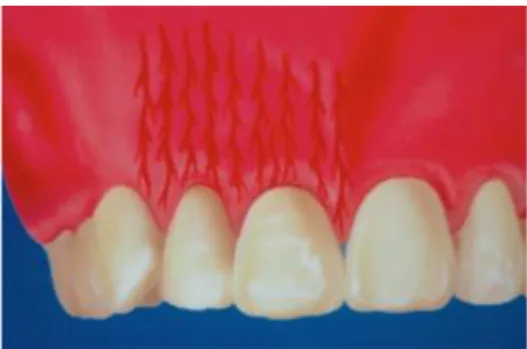 Figure 6 : schéma de la vascularisation de la gencive (Velvart, Peters 2005) 