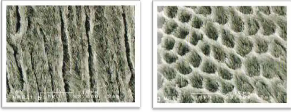 Figure 5 : Vues au microscope électronique à balayage des prismes d’émail en section  longitudinale (à droite) et transversale (à gauche) (× 3000) (6) 