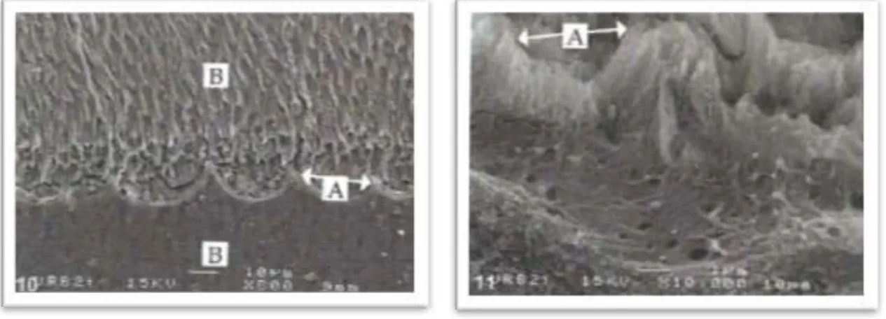 Figure 8 : Observation au microscope des macrofestons (à gauche) et des microfestons (à droite) de la  jonction amélodentinaire (6) 