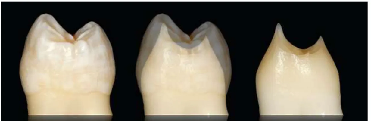 Figure 9 : Aspect convexe de l’émail et aspect concave de la dentine (2) 
