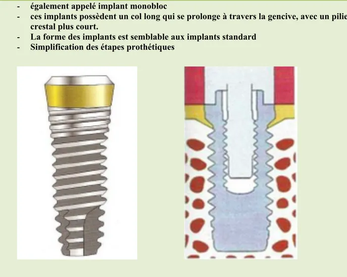 Figure 20 et 21 : implant transgingival et son schéma (19) 