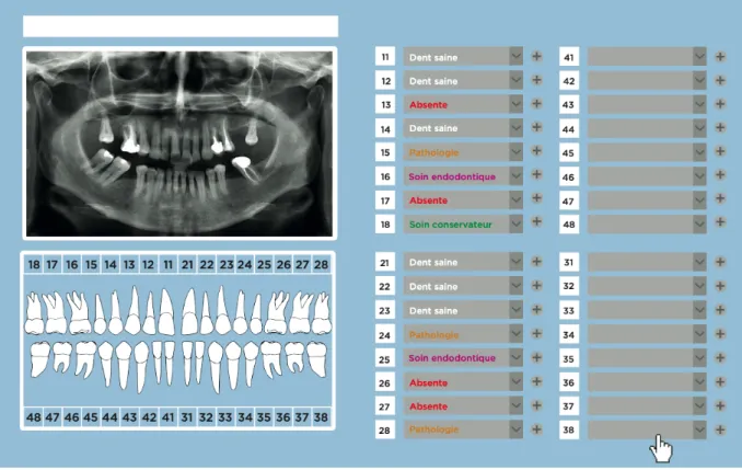 Figure 12 : Exemple de logiciel 1 