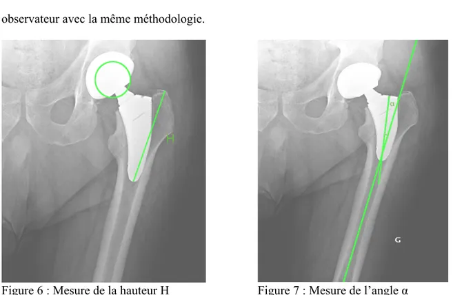 Figure 6 : Mesure de la hauteur H         Figure 7 : Mesure de l’angle α  