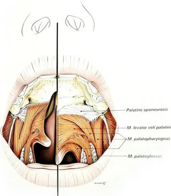 Figure 8 : Insertions musculaires du voile du palais d’un nouveau-né sans fente (à droite)  et chez un nouveau-né avec fente vélo-palatine (à gauche)  