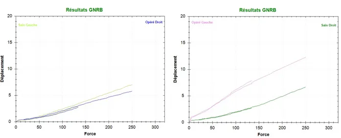 Figure 8: Résultats GNRB genou en flessum et genou laxe.  