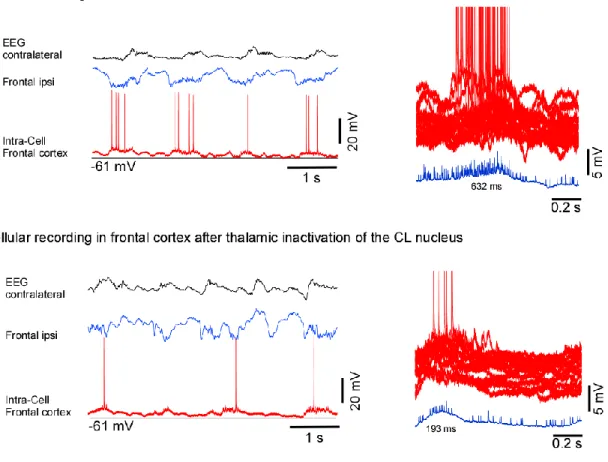 Figure  7.  Intracellular  and  LFP  recordings  of  neurons  within  frontal  cortex  during  slow wave oscillation in anesthetized mouse
